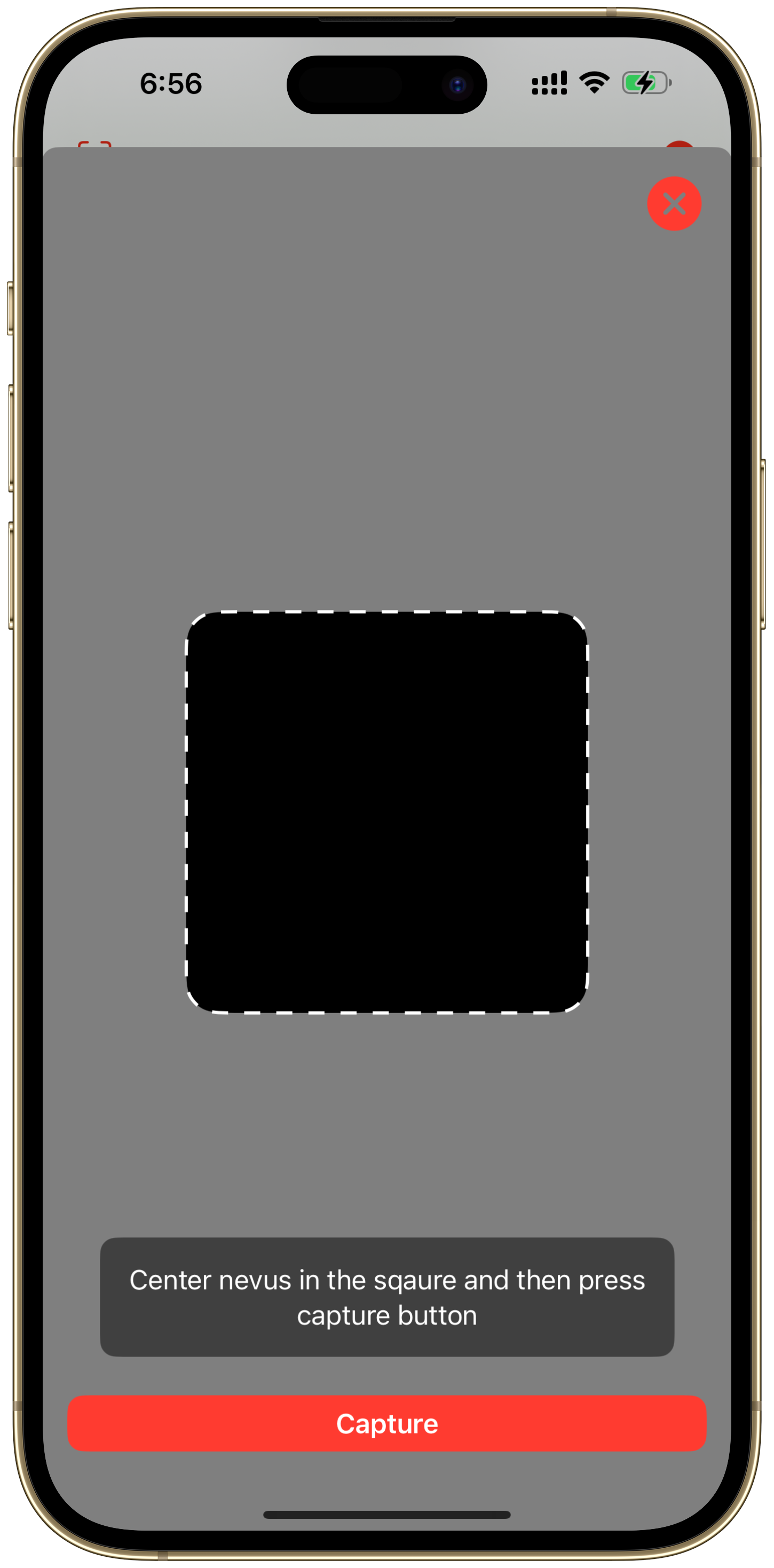 Nevus
